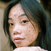 Skin Disorders and Cosmetics